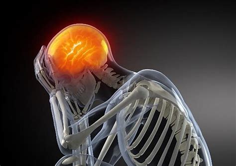 Как распознать сотрясение мозга Причины и симптомы сотрясения головного мозга