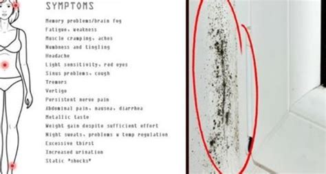 12 Signs That You Have Mold Illness And How To Treat It Mold