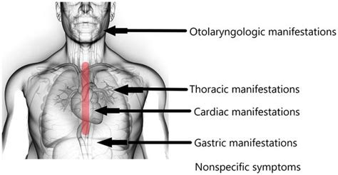 Extraesophageal Manifestations And Symptoms Of Esophageal Diseases
