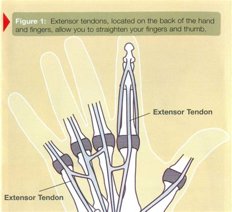 Thumb Extensor Tendonitis