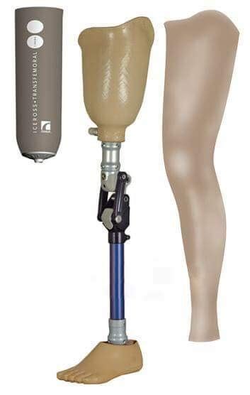 Above Knee Silicone Prosthesis Full Leg Rs 85000 Piece Nulife Health