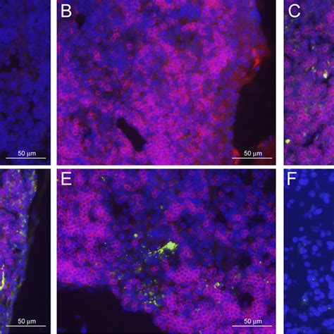 Viral N Protein Accumulation In The Draining Lymph Nodes Of Mice After