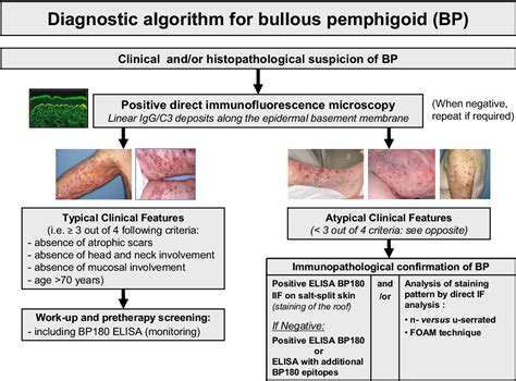 Bullous Pemphigoid A Review Of Its Diagnosis Associations And