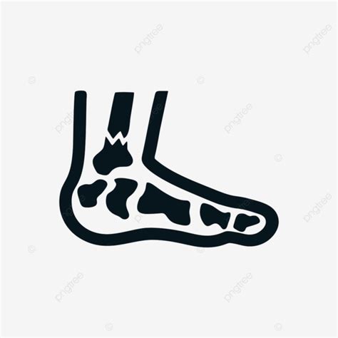 Foot Injury Clipart Transparent Png Hd Foot Fracture Injury Leg Icon