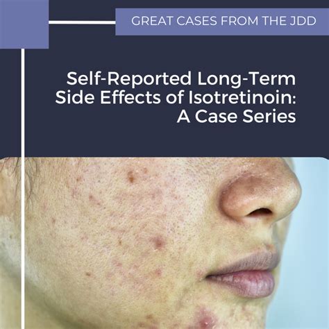 Self Reported Long Term Side Effects Of Isotretinoin A Case Series