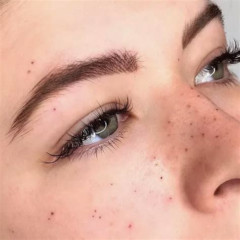 What You Should Know About Freckle Tattoos