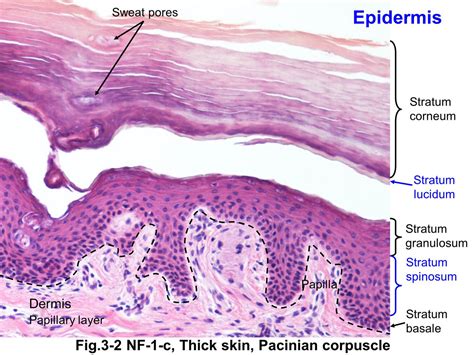 Block12fig 3 2 Epidermis Of Thick Skin