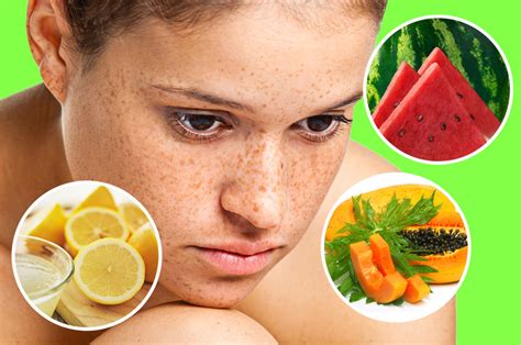 10 Tips To Get Rid Of Sunspots With Natural Remedies Healthw