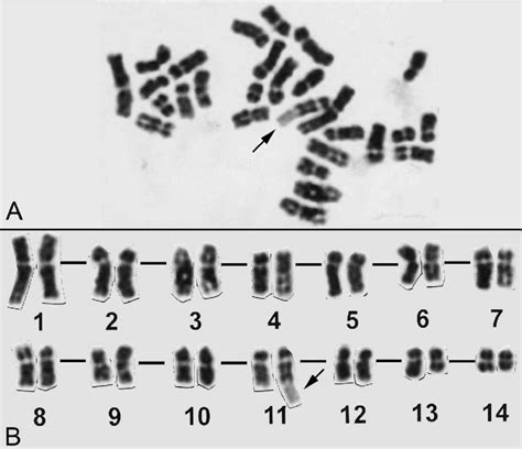 A G Banded Metaphase Spread A And Its Karyogram B Both Stained