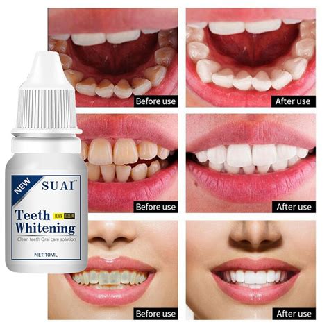 Teeth Whitening Essence Serum Oral Hygiene Care Cleaner Whiten Teeth