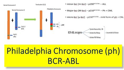 Philadelphia Chromosome Ph Introduction Variants Of Bcr Abl Gene