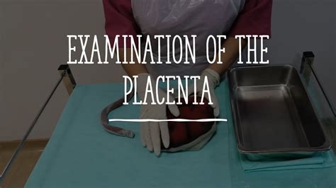 Obstetric And Gynecological Nursing Examination Of The Placenta Youtube