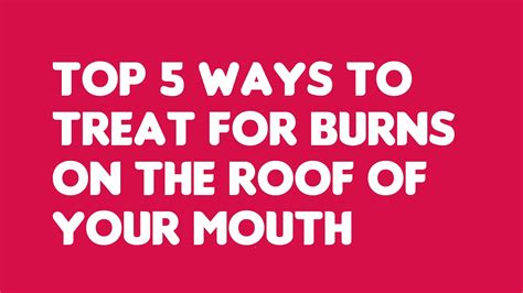 Top 5 Ways To Treat For Burns On The Roof Of Your Mouth Youtube