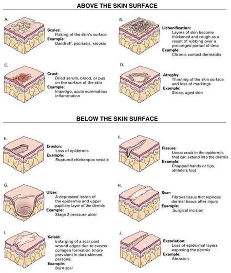 Secondary Lesions Nurse Work Related Pinterest Pa School