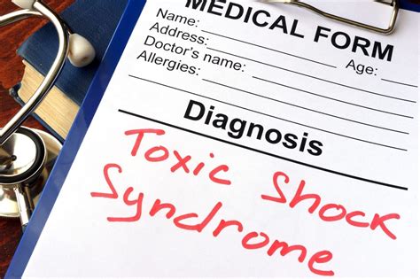 Toxic Shock Syndrome Symptoms And Causes