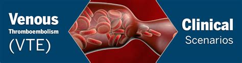 Venous Thromboembolism Vte Clinical Scenarios Indiana University