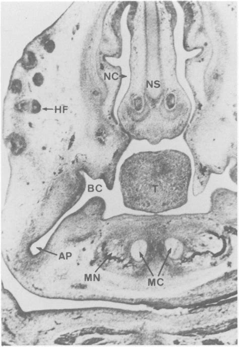 Transverse Section Across The Snout Of Dipodomys Panamintinus Theiler