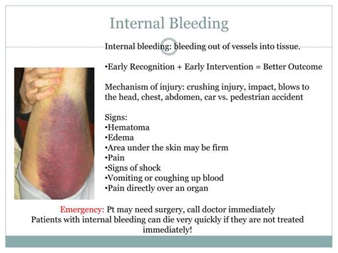 Ppt Shock And Bleeding In The Trauma Patient Powerpoint Presentation