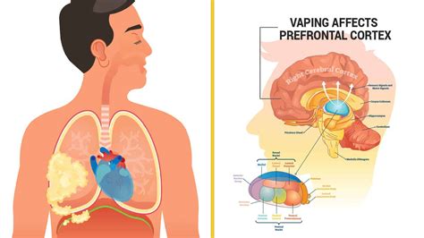 Researchers Reveal How Vaping Causes Brain And Lung Damage