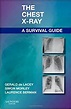 The Chest X-Ray: A Survival Guide, 1e: 9780702030468: Medicine & Health ...