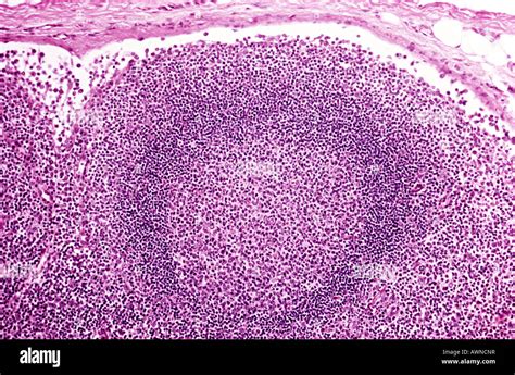 Lymph Node Micrograph Hi Res Stock Photography And Images Alamy
