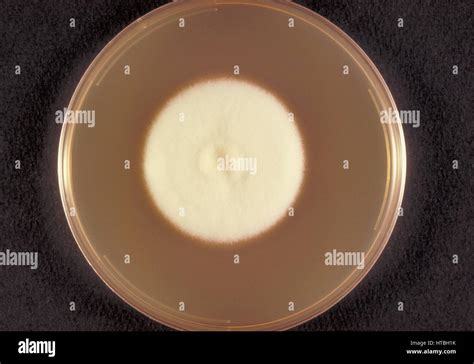 Top View Of A Sabouraud Dextrose Agar Plate Culture Growing The
