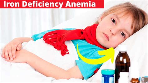 Best Treatment For Iron Deficiency Anemia In Children Youtube