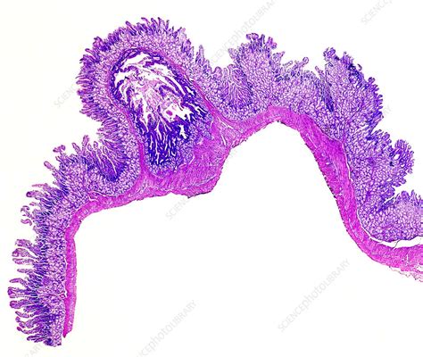 Human Duodenum Light Micrograph Stock Image C0488557 Science