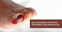 Gas Gangrene: Causes, Symptoms, Prevention and Treatment