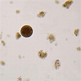 Carolina Biological Supply Company Entamoeba coli Trophozoites, smear ...