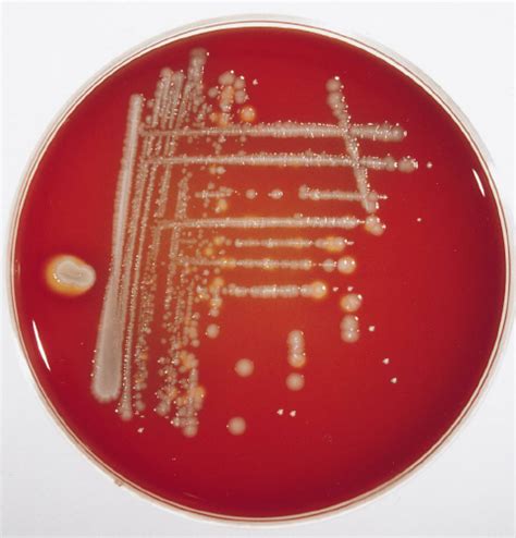 Enterohemolysin Agar Plate Inoculated With The Stool Culture Of Patient