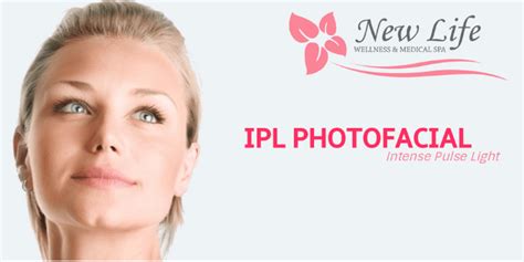 Ipl Photofacial Tomball Tx New Life Wellness And Medical Spa