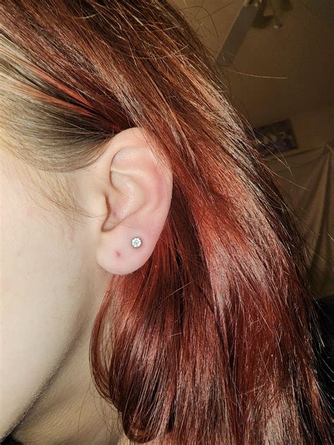 possible lobe piercing infection r piercing