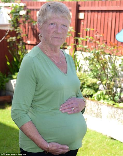 grandmother looks pregnant because two huge hernias the size of a sexiz pix