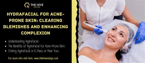 Hydrafacial For Acne Prone Skin Clearing Blemishes And Enhancing