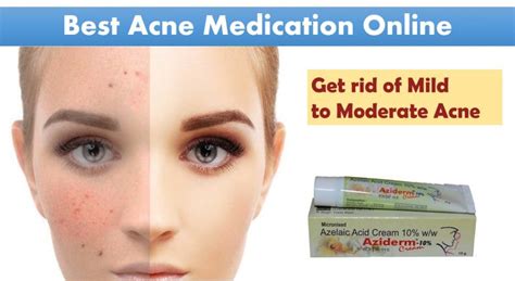 Best Acne Medication Online Cosmetics And You Acne Treatment Careprost Eyelashes Careprost