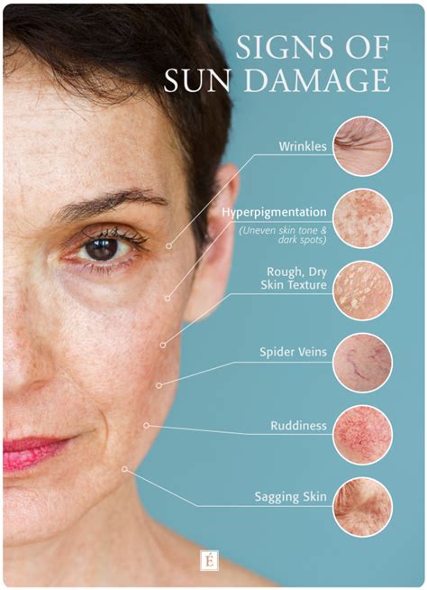 What Does Sun Damaged Skin Look Like Eminence Organic Skin Care Skin