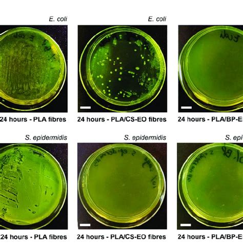 A Photographs Of Agar Plates Showing The Growth Of E Coli Upper