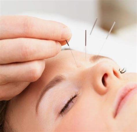 acupuncture face health for your whole lifehealth for your whole life