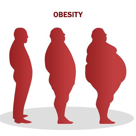 Obesity Causes