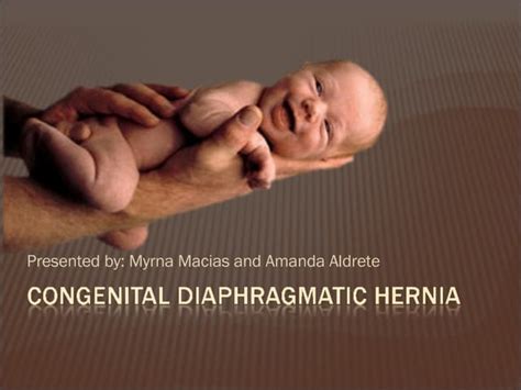 Anesthesia For Congenital Diaphragmatic Hernia