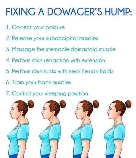 Dowager S Hump Fix Avoid A Dowager S Hump Granny Health Today Posture Correction Exercises