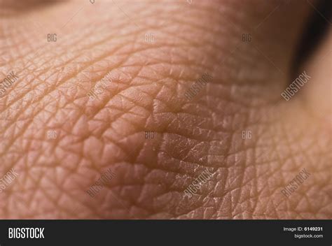 Human Skin Closeup Image Photo Free Trial Bigstock