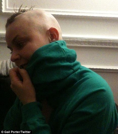 Gail Porter Shaves Her Head After Alopecia Returns Daily Mail Online