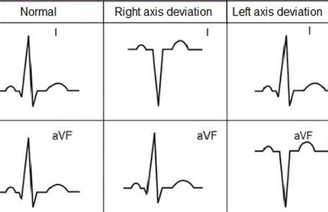 Check spelling or type a new query. ECG Basics Step 1 - MedweiSer Health