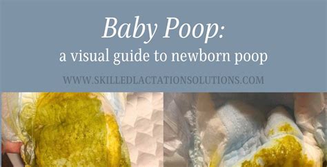 Baby Poop A Visual Guide To Newborn Poop