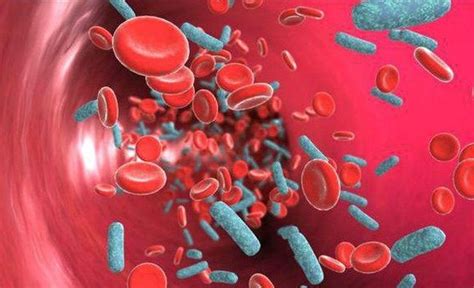 Sepsis Blood Poisoning Symptoms Treatment Prevention