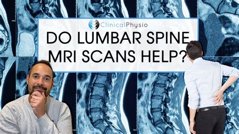 Are Mri Scans Always Helpful In The Diagnosis Of Low Back Pain Expert Physio Reviews The