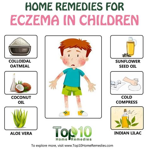 Home Remedies For Eczema In Children Top 10 Home Remedies
