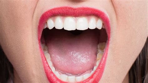 Excessive Saliva Production What It Means For Oral Cavity Expert Explains Onlymyhealth